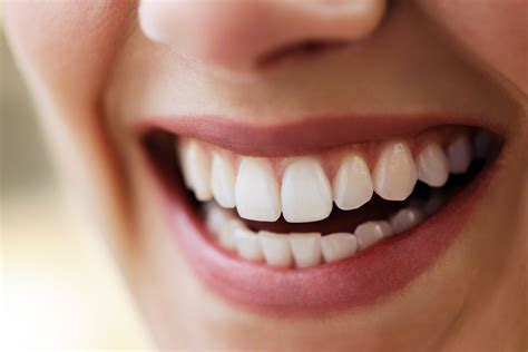 Natural Teeth Whitening: The Magical Solutions for a Beautiful Smile